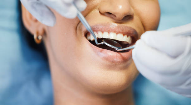 Best Emergency Dental Care for Broken or Chipped Teeth in East Palestine, OH