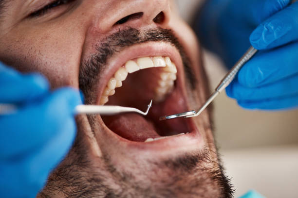 Best Emergency Treatment for Dental Infections or Abscesses in East Palestine, OH